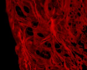Guía Completa sobre el Colágeno Hidrolizado: Tipos, Beneficios y Consejos de Suplementación